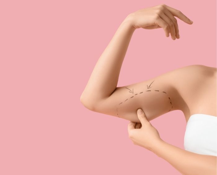 The Positive Psychological Effects of Arm Lift Surgery